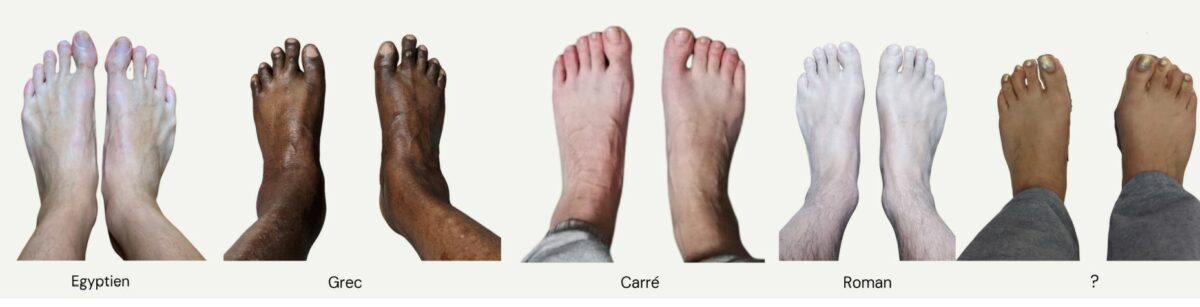 Quel est votre type de pied ? -  - Chausse toi