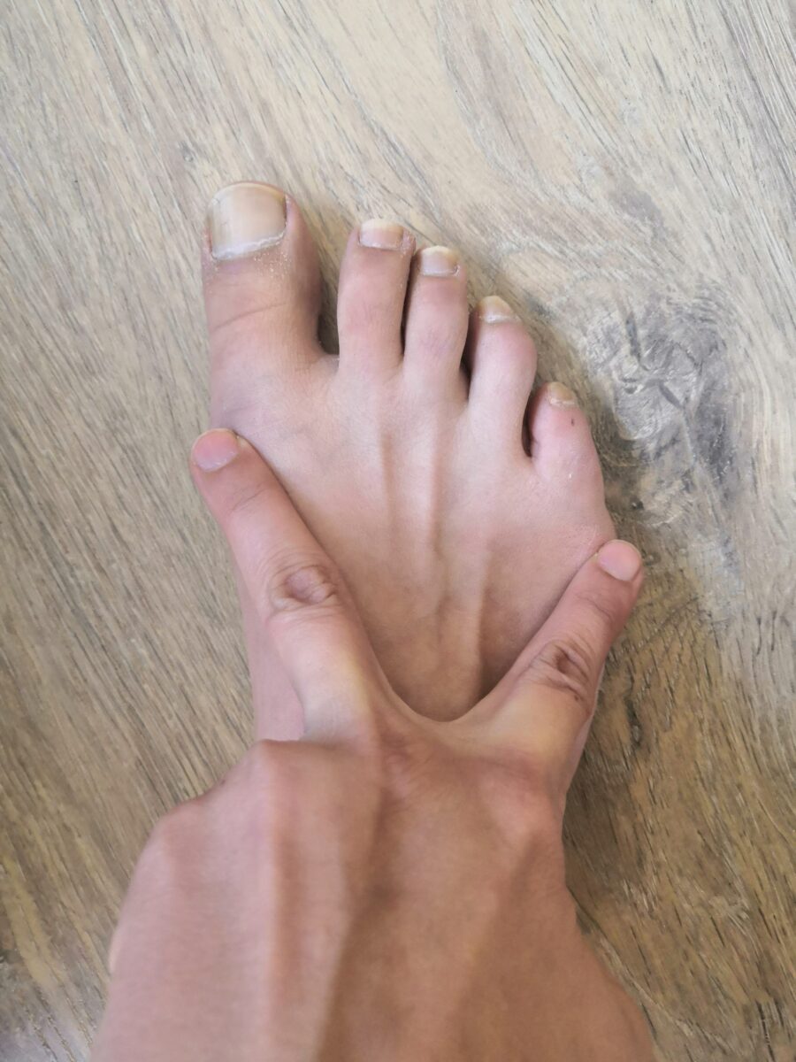 Quel est votre type de pied ? -  - Chausse toi