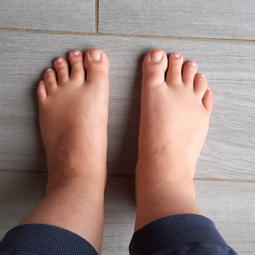 Quel est votre type de pied ? -  - Chausse toi